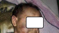 رماه من اعلى عمارة ثم قام بحرقه.. تفاصيل دامية لتخلص اب من ابنه المصاب بالتوحد