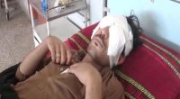 بالفيديو .. ​رجل يقتلع عيني نجله بـ"ملعقة" لسبب صادم