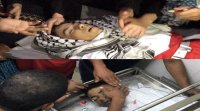 غزة .. شهيد ثانٍ متأثرا بإصابته الجمعة