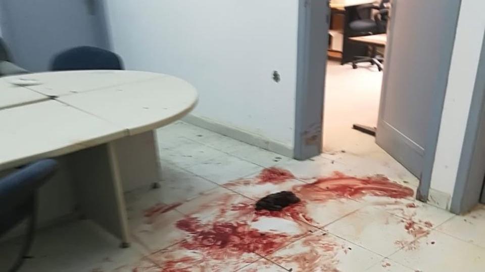 صور بشعة.. السعودية: عامل فلبيني يقتل مدير كهرباء