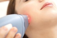 "الصحة" تشترط فحص طبي قبل اجراء ليزر الشعر