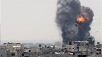 وطنية الاسنان تدين العدوان على غزة وتطالب بوقف أشكال التطبيع
