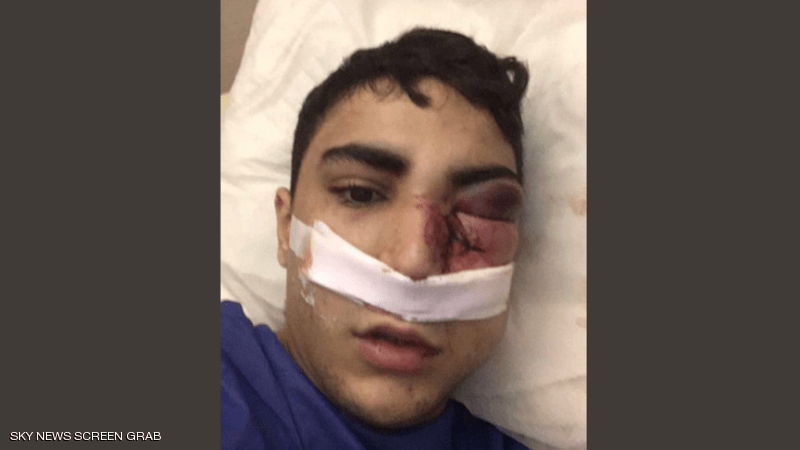 تفاصيل جديدة وصور من حادثة طعن عريس داخل قاعة زفاف