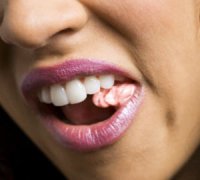 نتائج الفحوصات المخبرية لـ"علكة الكيف"