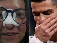 بعد أن كسر أنفها.. رونالدو يجبر خاطر "الضحية"
