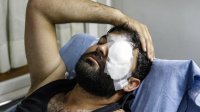 الرزاز يوجه بمتابعة حالة المصور العمارنة