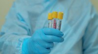 جمع عينات عشوائية لقياس المناعة المجتمعية في جرش