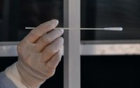 لجنة الأوبئة تؤكد دخول الأردن مرحلة الانتشار المجتمعي للوباء