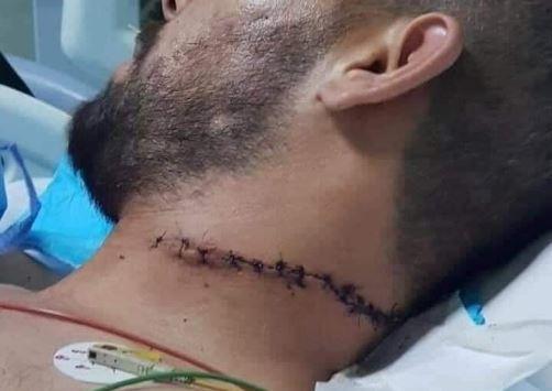 فارضو أتاوات يعتدون على صاحب محل بالقويسمة