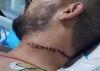فارضو أتاوات يعتدون على صاحب محل بالقويسمة