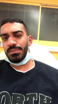 بالتفاصيل والصور.. اعتداء عنصري على شاب أردني وشقيقته في فرنسا