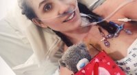 عملية رائدة تستنزف دماء امرأة لعلاج جلطات قاتلة في رئتيها