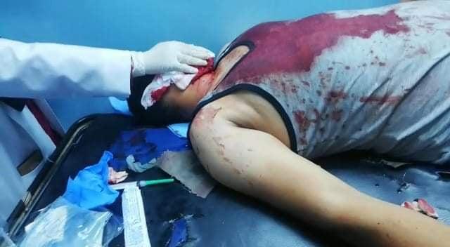 الاعتداء على شاب بالاسلحة البيضاء باربد