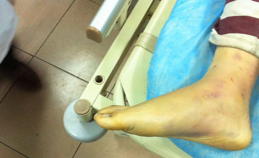 ابن يعذب امه السبيعينة حتى الموت بالاشتراك مع زوجته في الامارات