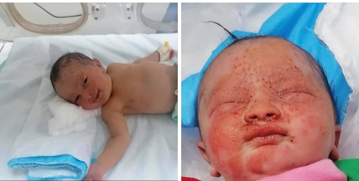 تآكل وجهها من قرصات النمل.. قصة مؤثرة لرضيعة ملقاة بالعراء في الشونة الجنوبية