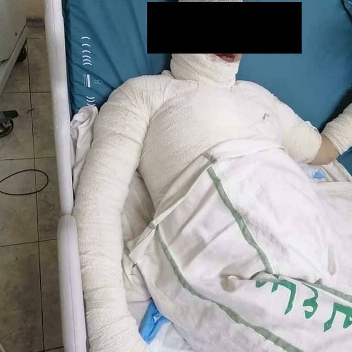 "مسح كل حياتي"...آخر كلمات زوجة قتلها زوجها حرقاً وتوفيت بعد اسبوع من بقائها في المستشفى