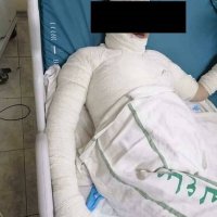 "مسح كل حياتي"...آخر كلمات زوجة قتلها زوجها حرقاً وتوفيت بعد اسبوع من بقائها في المستشفى