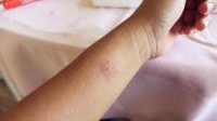 ما قصة حشرة النمر بجديتا؟ الخلايلة يوضح