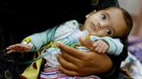 أطباء زاروا غزة يتحدثون عن "فظائع" وتداعي الرعاية الصحية