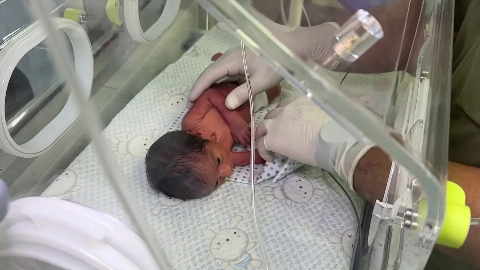 خطر يهدد المواليد في غزة مع تصاعد حالات الاجهاض