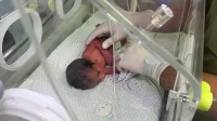 خطر يهدد المواليد في غزة مع تصاعد حالات الاجهاض