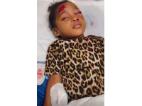 كلب ضال ينهش طفلة أمام منزلها بالأغوار الجنوبية.. ومطالبات بحلول عاجلة