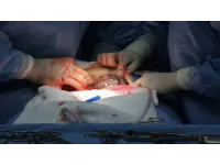 تدخل جراحي نوعي لتأمين مجرى التنفس لجنين أثناء الولادة في مستشفى الجامعة الأردنية